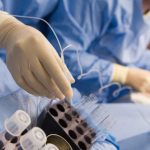 肯尼亚国外代孕