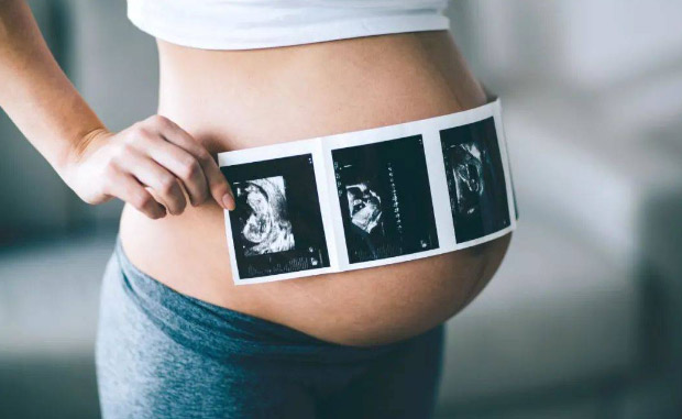 吉尔吉斯斯坦代孕靠谱公司